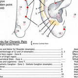 Ear Wall Chart of Chronic Pain Points Ear Wall Chart of Chronic Pain Points
