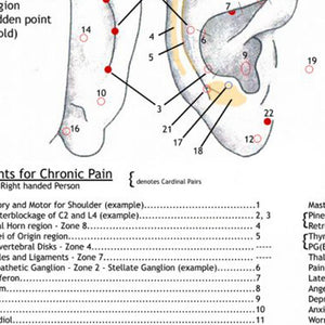 Ear Wall Chart of Chronic Pain Points