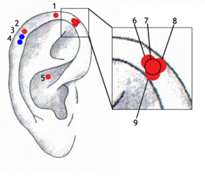 Ear Wall Chart of Indicator Points for Trace Elements and Vitamins