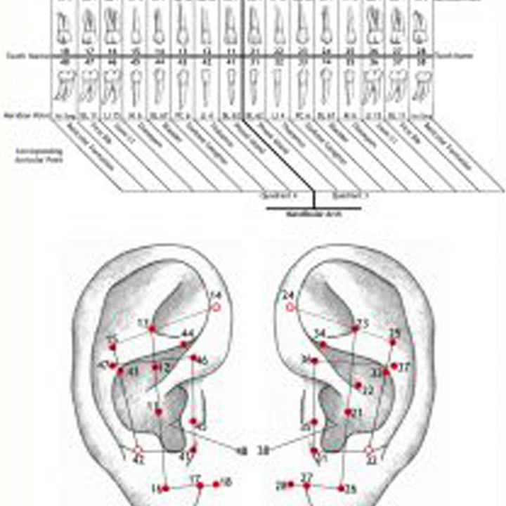 Ear Wall Chart Of Teeth And Their Corresponding Auricular Points